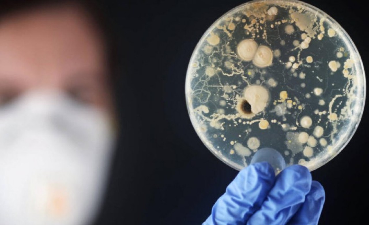 Beyin yiyen amip yeniden ortaya çıktı: Havuzdan bulaşıp,  1 haftada öldürüyor!