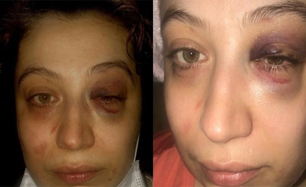 Eşi tarafından darp edildiğini iddia eden kadının yardım çığlığı sosyal medyanın gündemine oturdu!