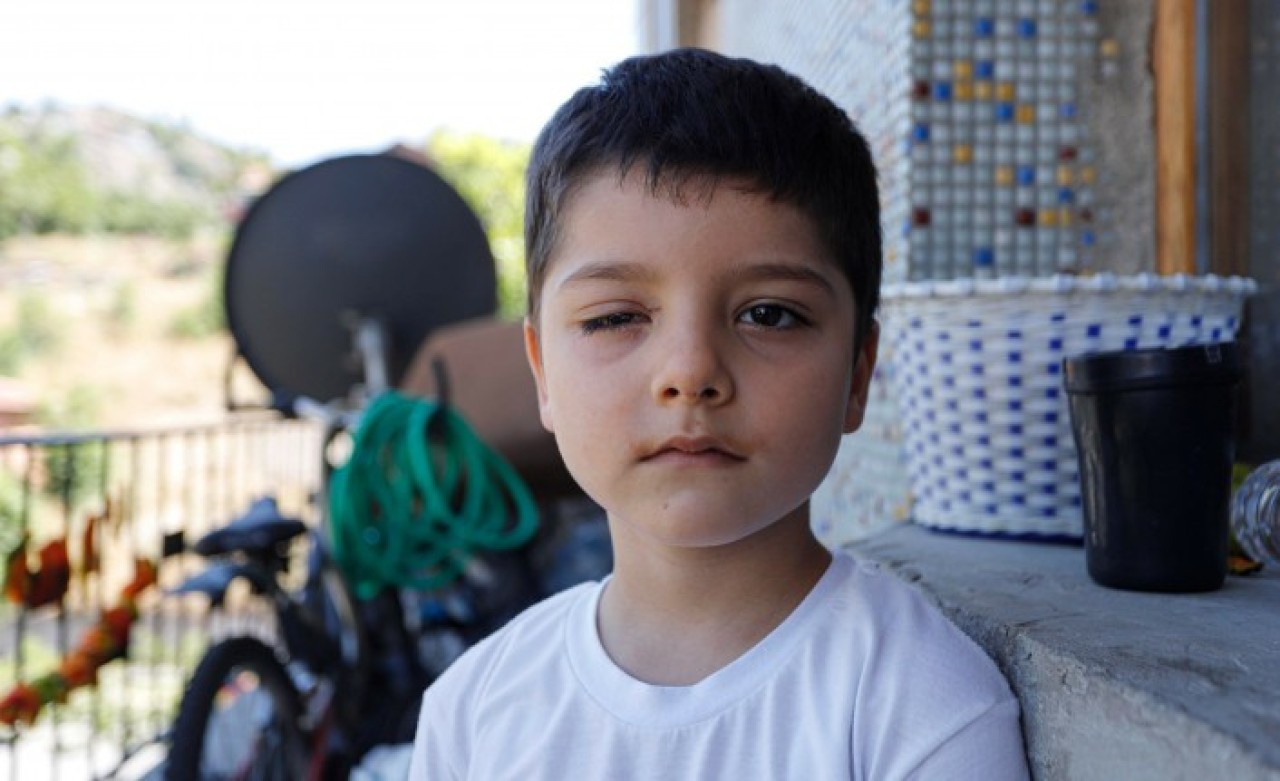 Minik Çınar Tiktok soda açma akımı yüzünden gözünden oldu!