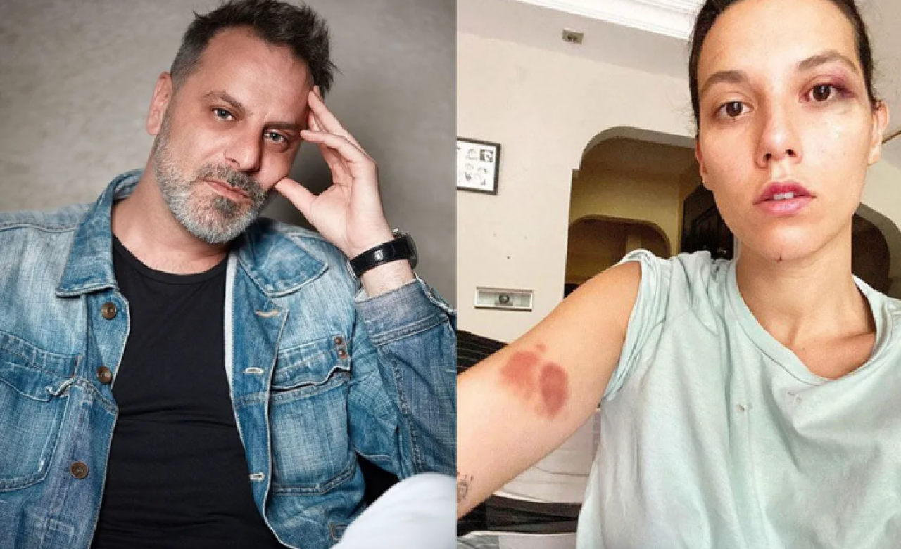 Ozan Güven'in şoförünün ifadesi ortaya çıktı: Olayın tüm seyri değişti!