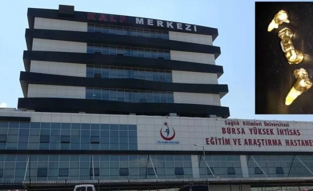 Ameliyat öncesi teslim ettikleri altın dişler,  başka hastaya verilmiş