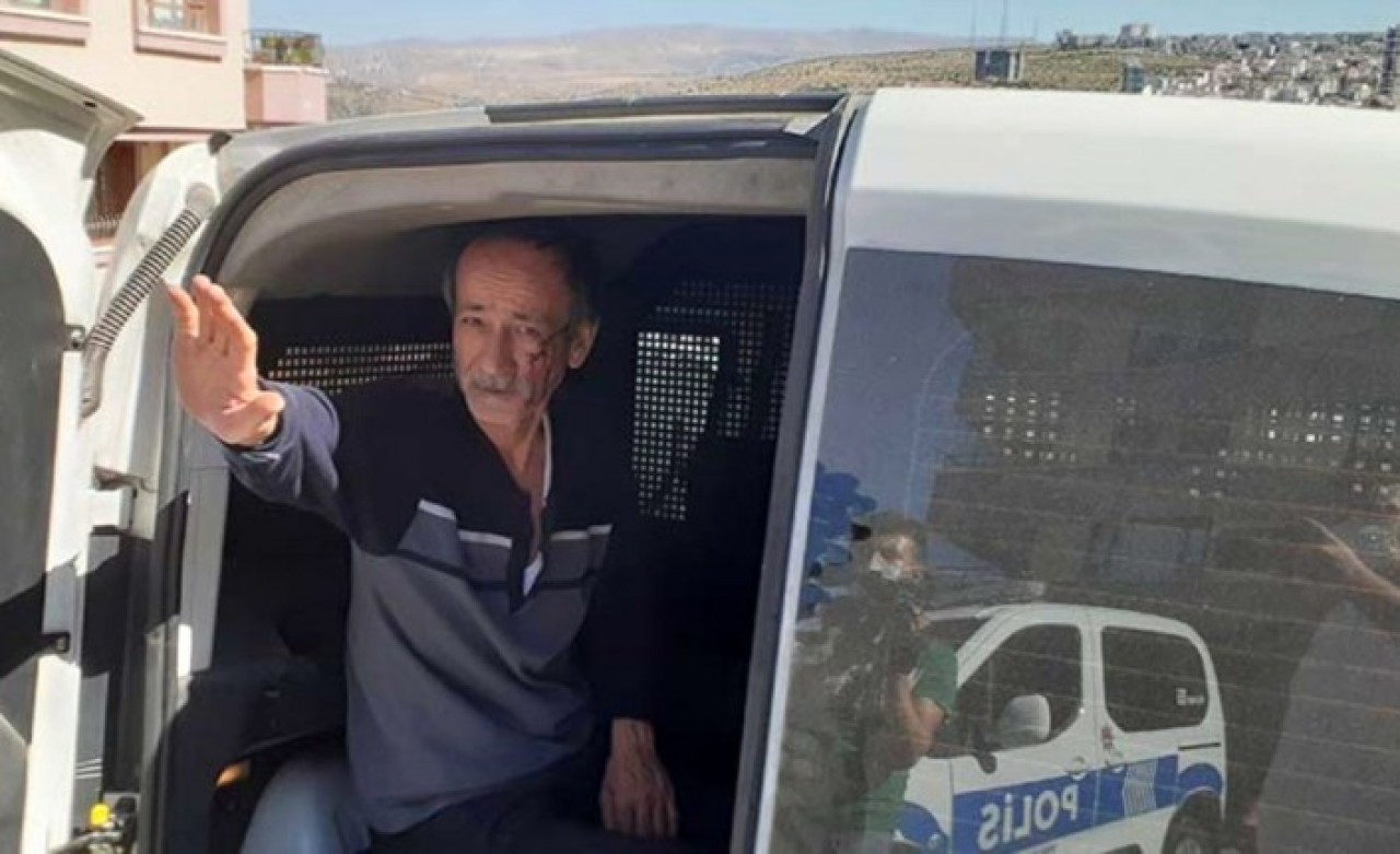 Cani koca,  karısının parmağını ısırarak koparttı