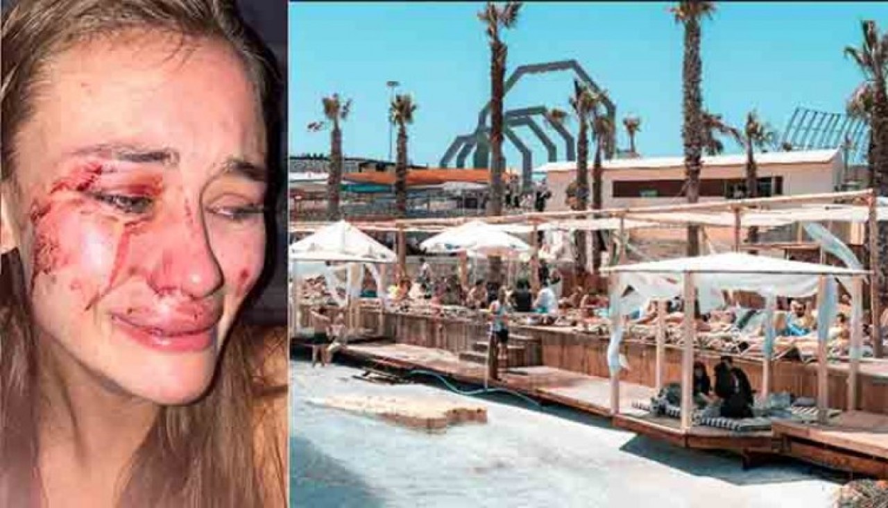 Modele dayak olayında flaş gelişme: Çeşme'deki o mekan kapatıldı