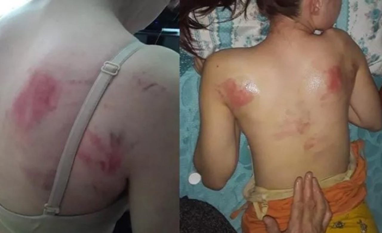 Tekirdağ'da vicdansız adam,  telefon şifresini söylemeyen kızını,  ingiliz anahtarıyla dövdü