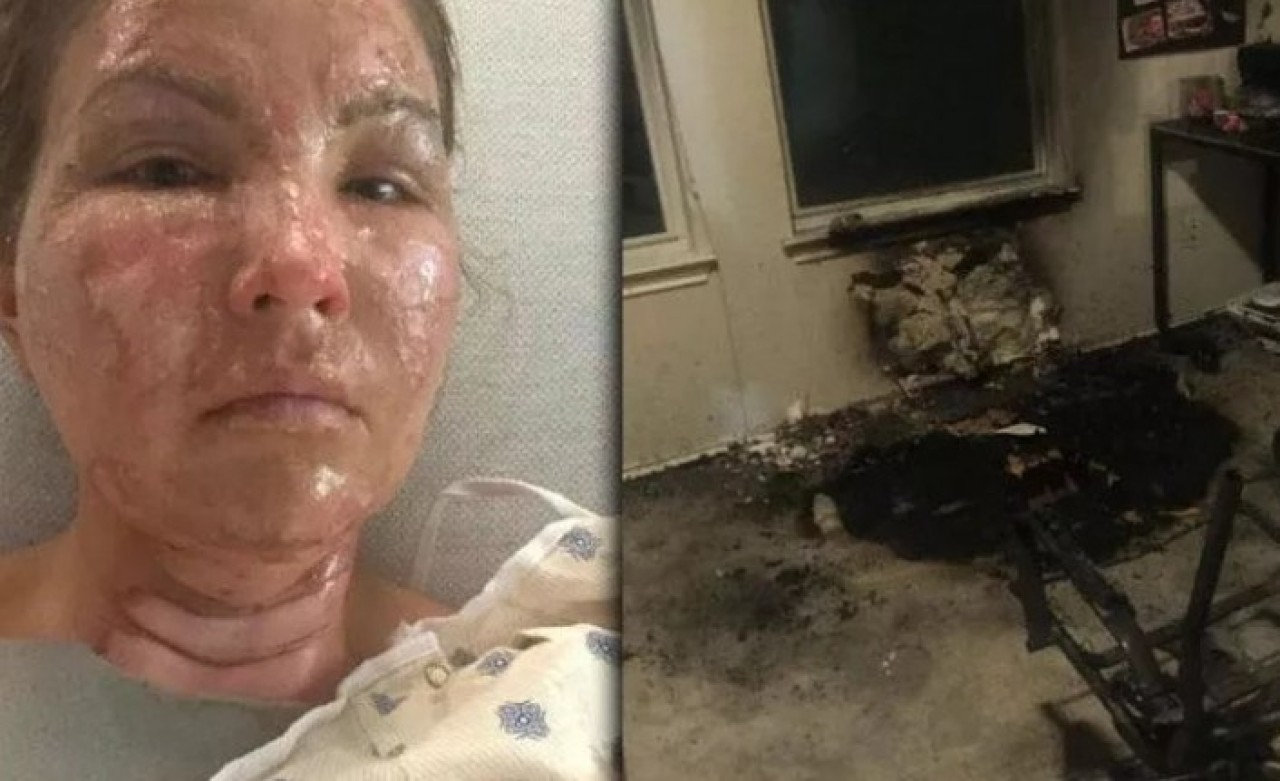 Dezenfektan kullanıp mum yaktı,  bu hale geldi! Uzmanlar uyardı