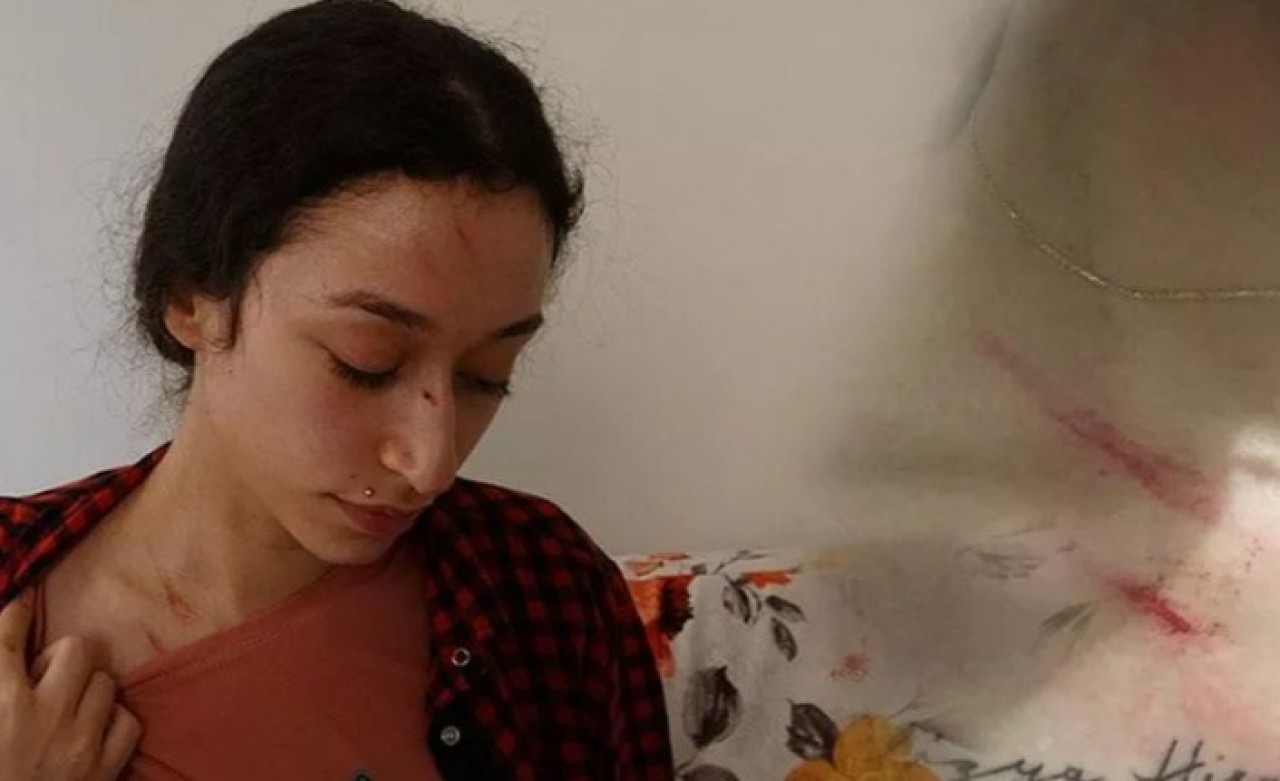 Eşinden şiddet gören Buse'nin yardım çığlığı: Bebeğimi 12'nci katın balkonundan sarkıttı