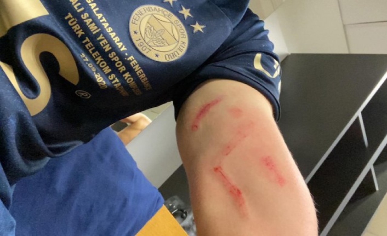 Fenerbahçe'den Ferdi Kadıoğlu paylaşımı: "Yorumsuz"