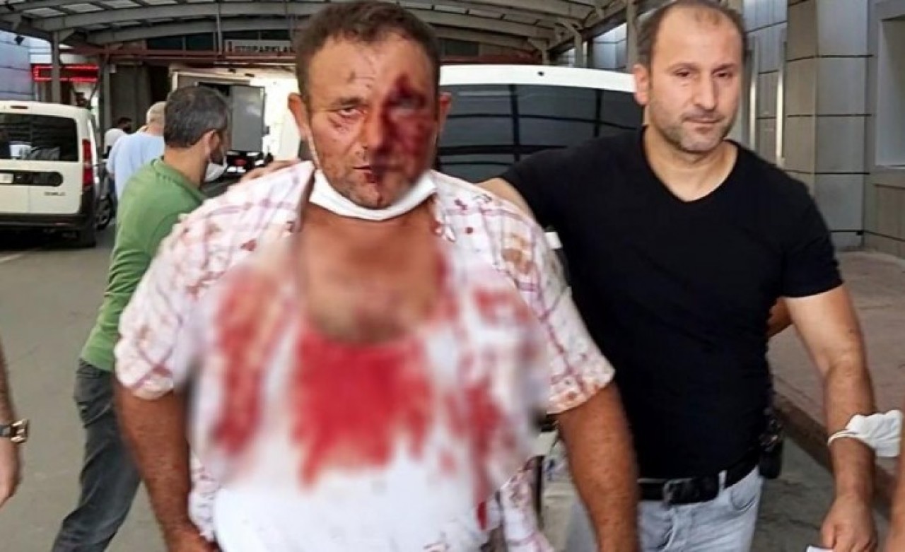 Salça kazanı yüzünden evlat katili oldu: Oğlunu pompalı tüfekle öldürdü!