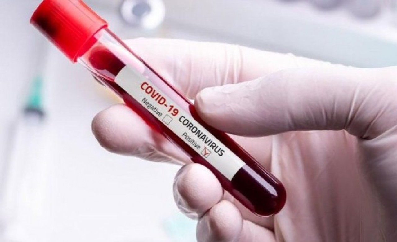 Şoke eden 'koronavirüs' tespiti: Pozitif sonuçlar sisteme girilmedi