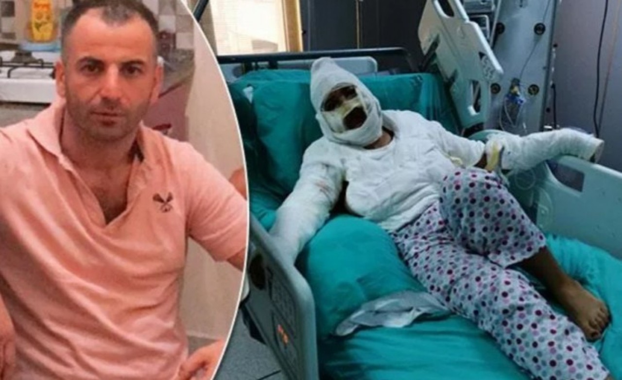 Yüzüne kızgın yağ döken erkek arkadaşı ceza alınca Kübra Tayfur ağladı