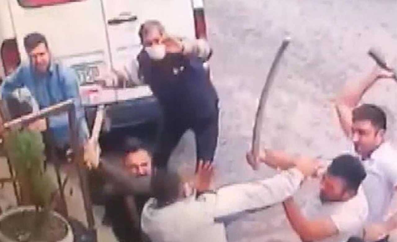 Bunun adı vahşet: Avcılar'da aracını park ettiği yer yüzünden balta ile darbedildi