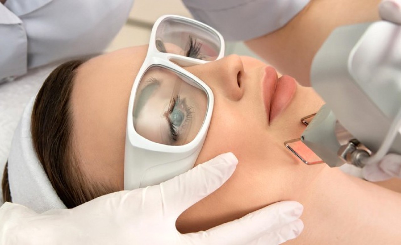 Buz Lazer Hakkında Sıkça Sorulan Sorular