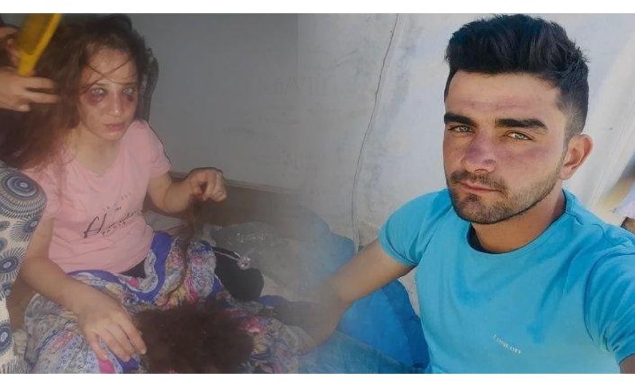 Eşine işkence yaptı,  serbest kaldı: 'Ne oldu tutuklatabildiniz mi?'