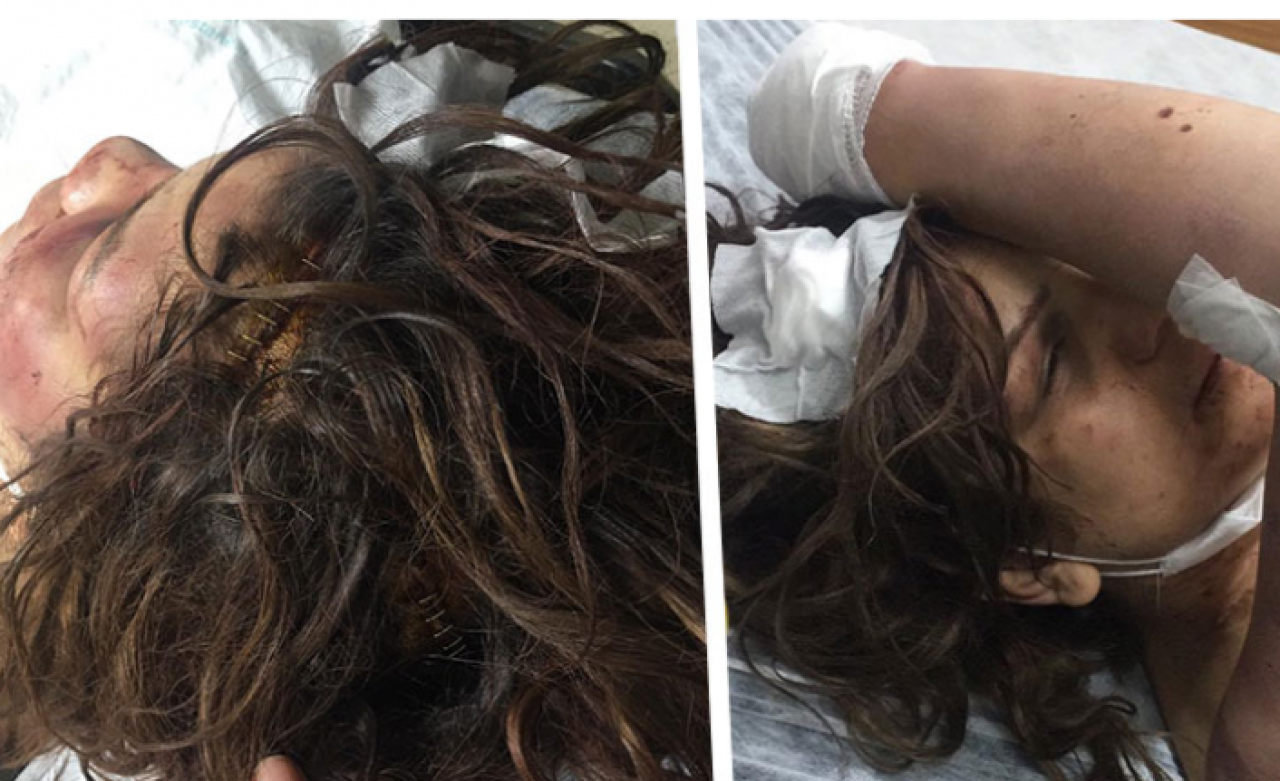 Şanlıurfa'da korkunç olay: Böyle vahşet görülmedi!