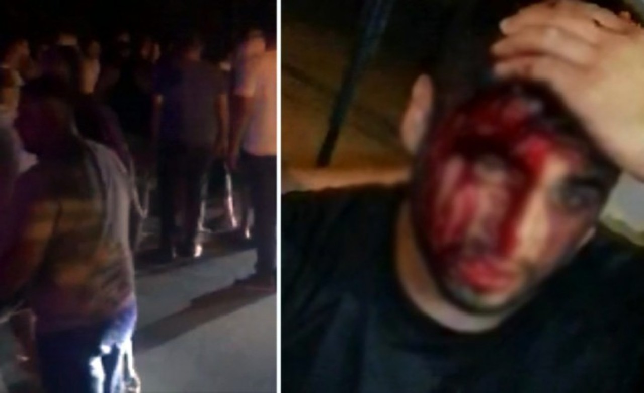 Sigara içmek için çakmağını çakan genci tekme tokat dövdüler