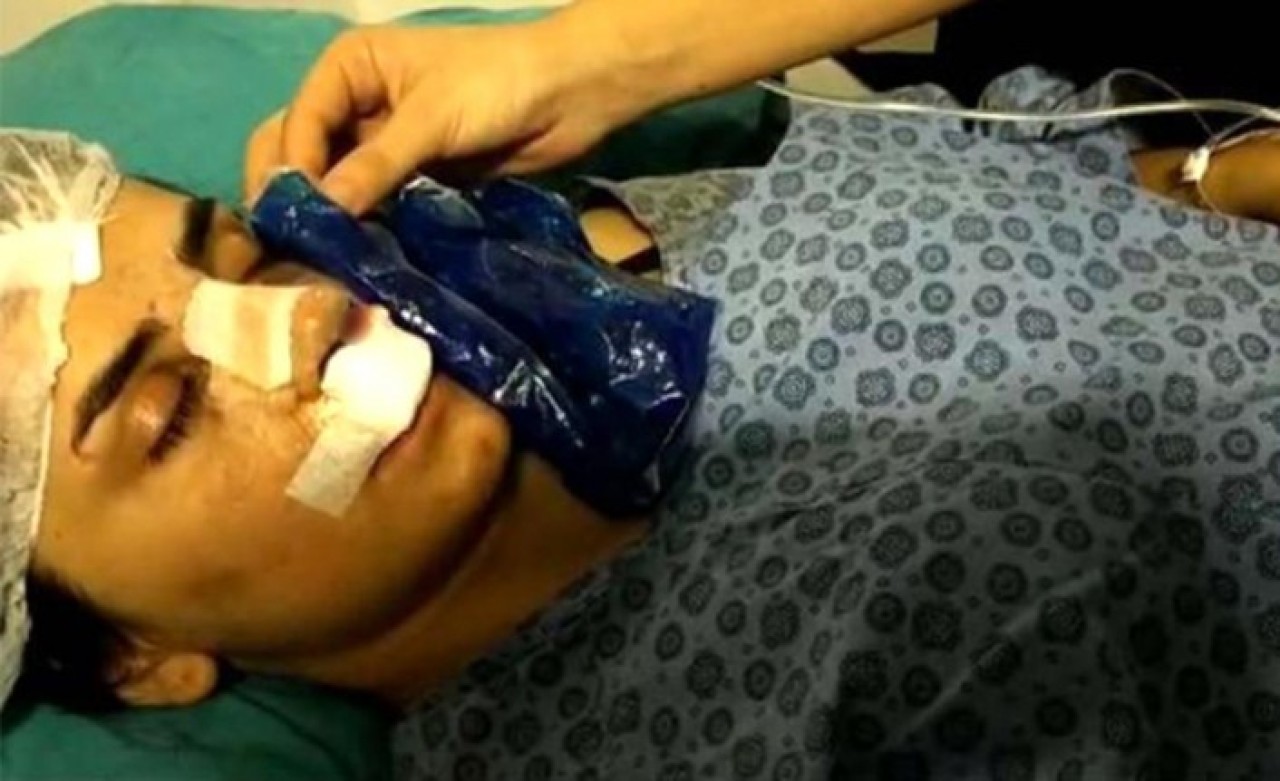 Ameliyattan çıkan kadının narkozun etkisiyle söylediği sözler arkadaşlarını şaşkına çevirdi