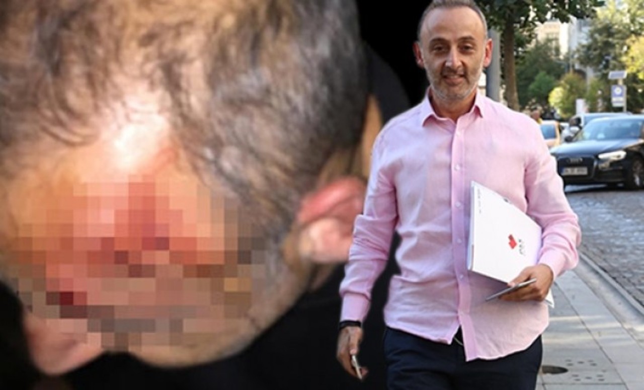 Kaşıbeyaz Restoran'ın ortağı Suat Kaşıbeyaz'a hastanede dayak!