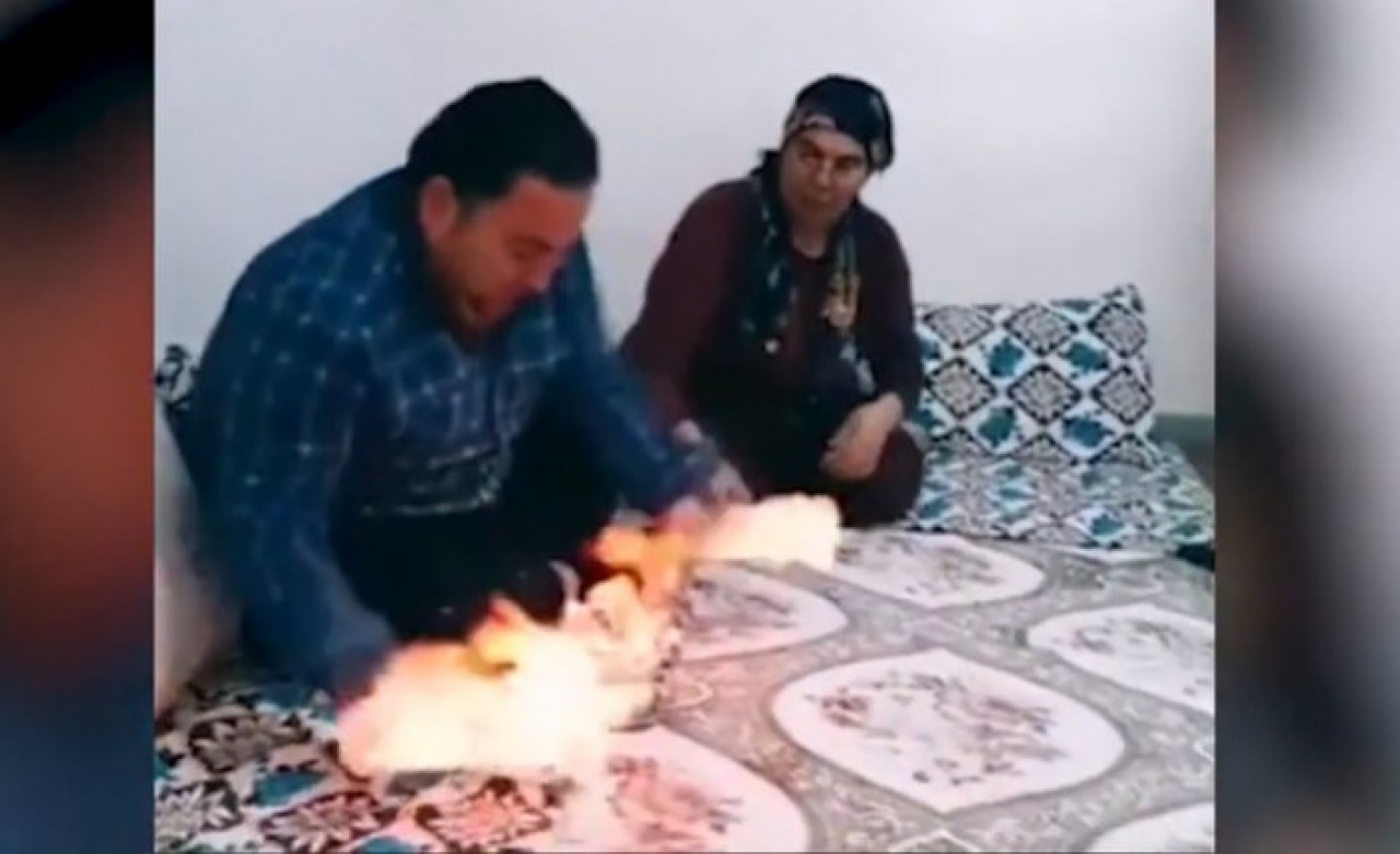 Bu kadarına da pes! TikTok videosu için eşinin ellerini çakmakla yaktı