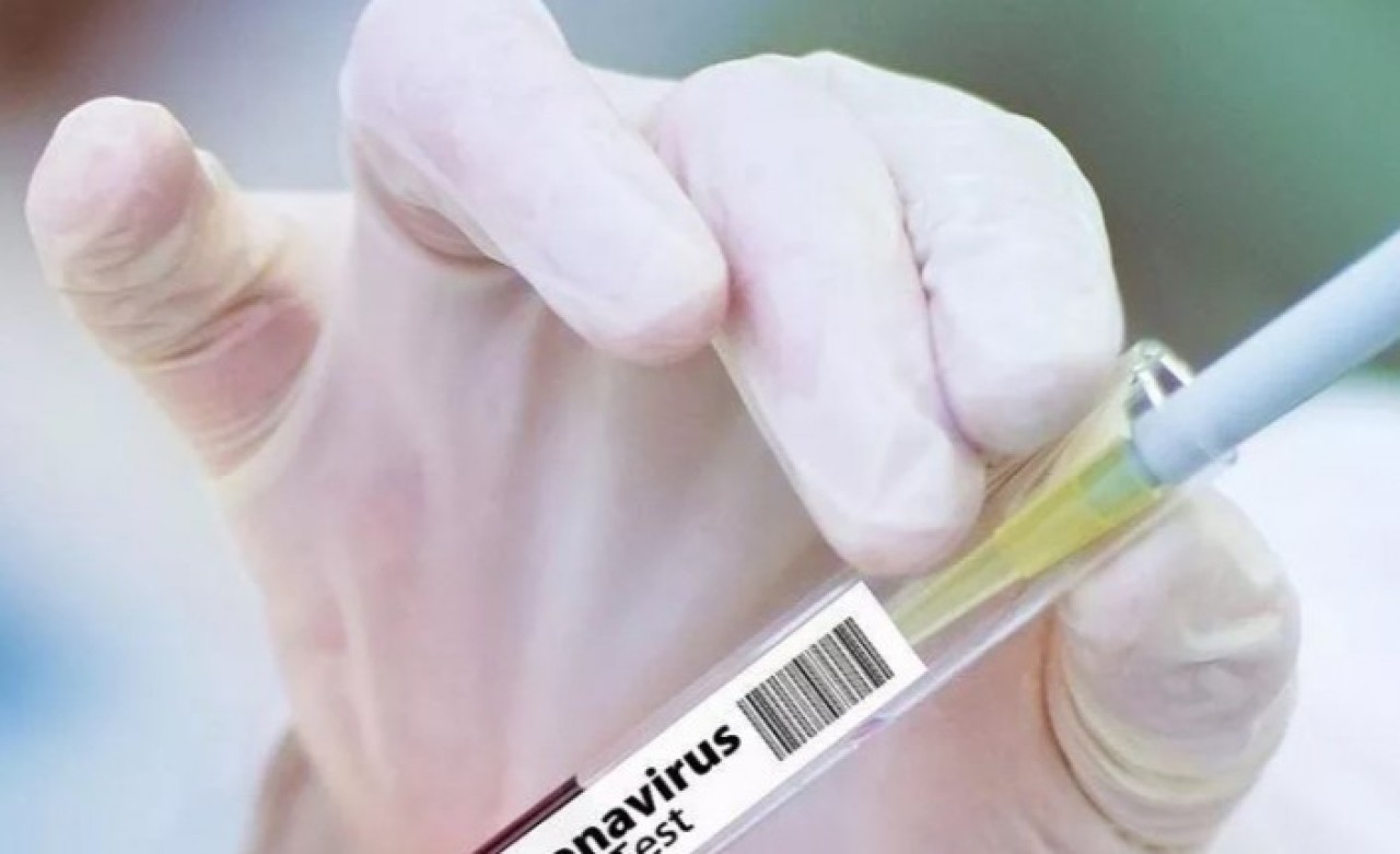 İngiltere ve Rusya aşı ortaklığını duyurdu