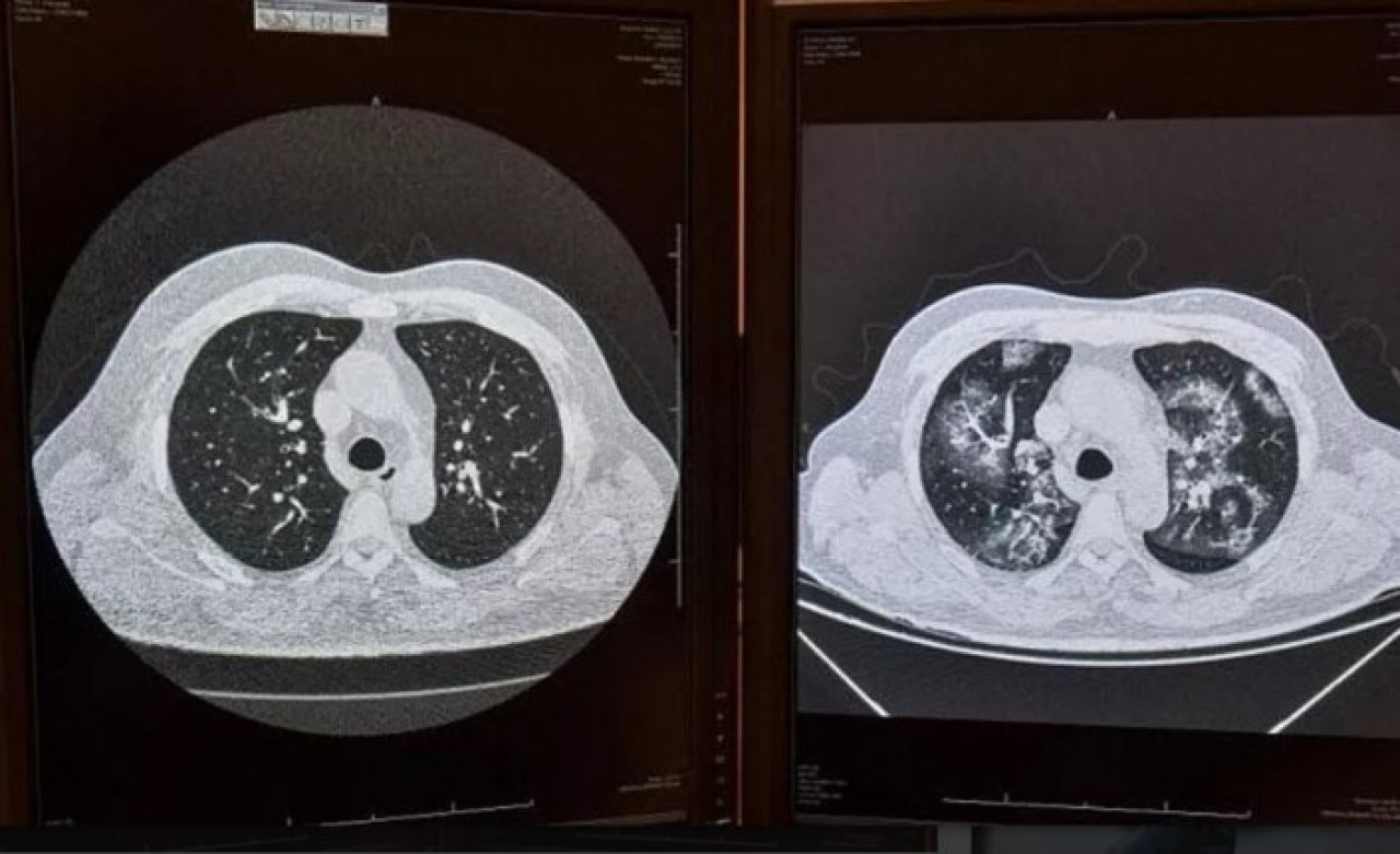 Koronavirüs tespitinde yeni yöntem geliştirildi