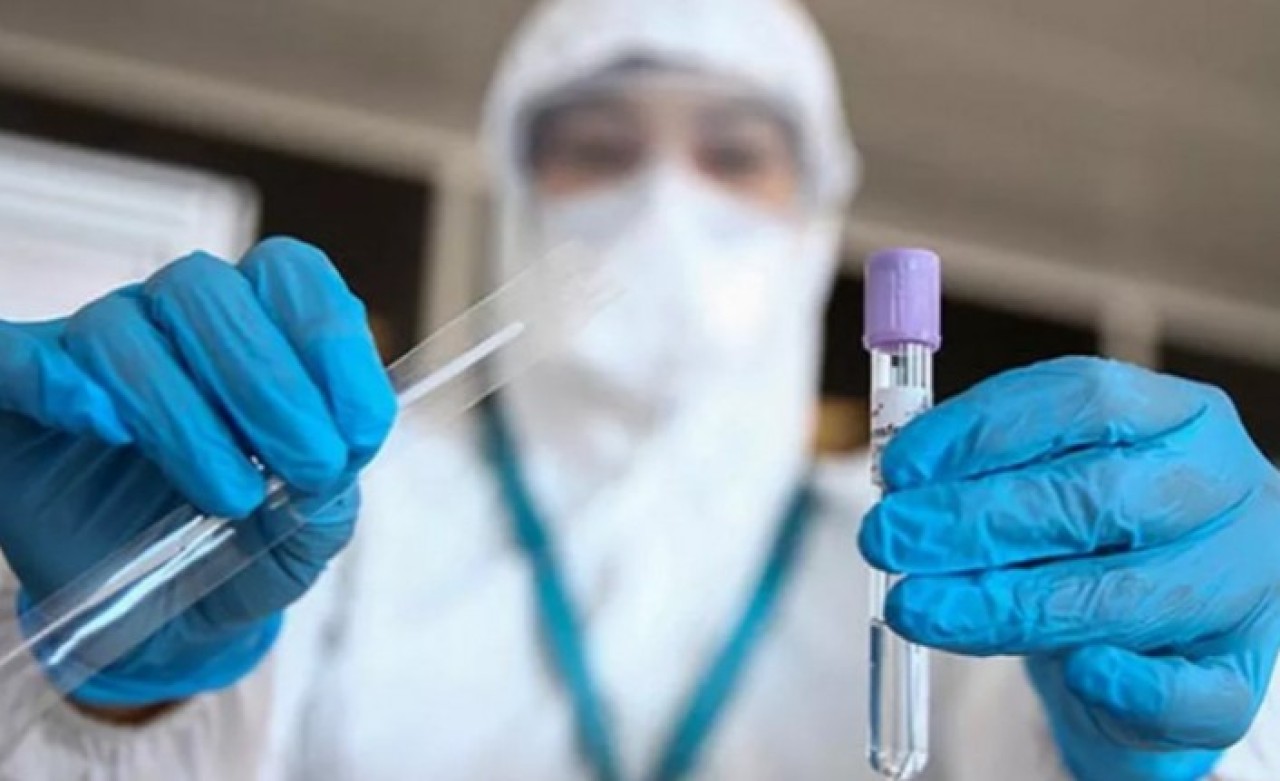 "Kovid-19 testlerini Menzil yapıyor" haberlerine İstanbul İl Sağlık Müdürlüğü'nden açıklama