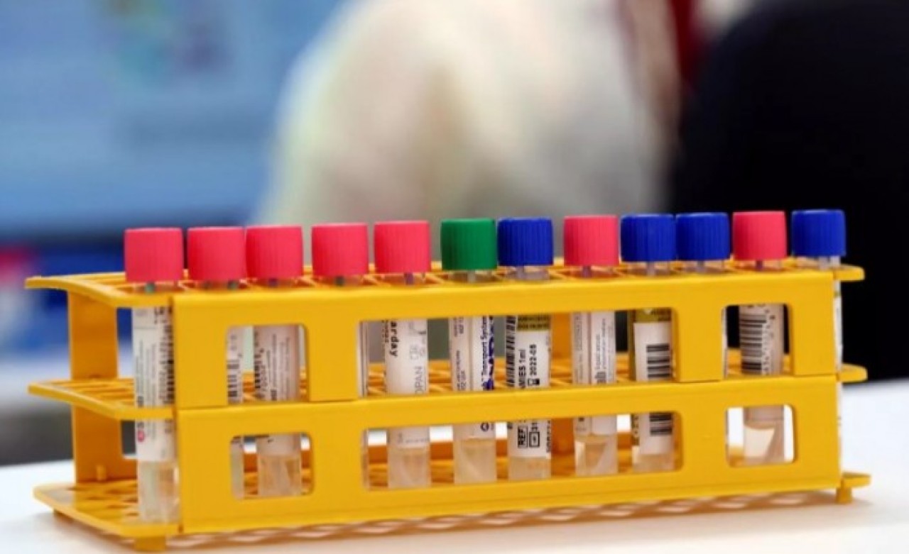 Valilik duyurdu: Şehir dışından gelenlere test kararı