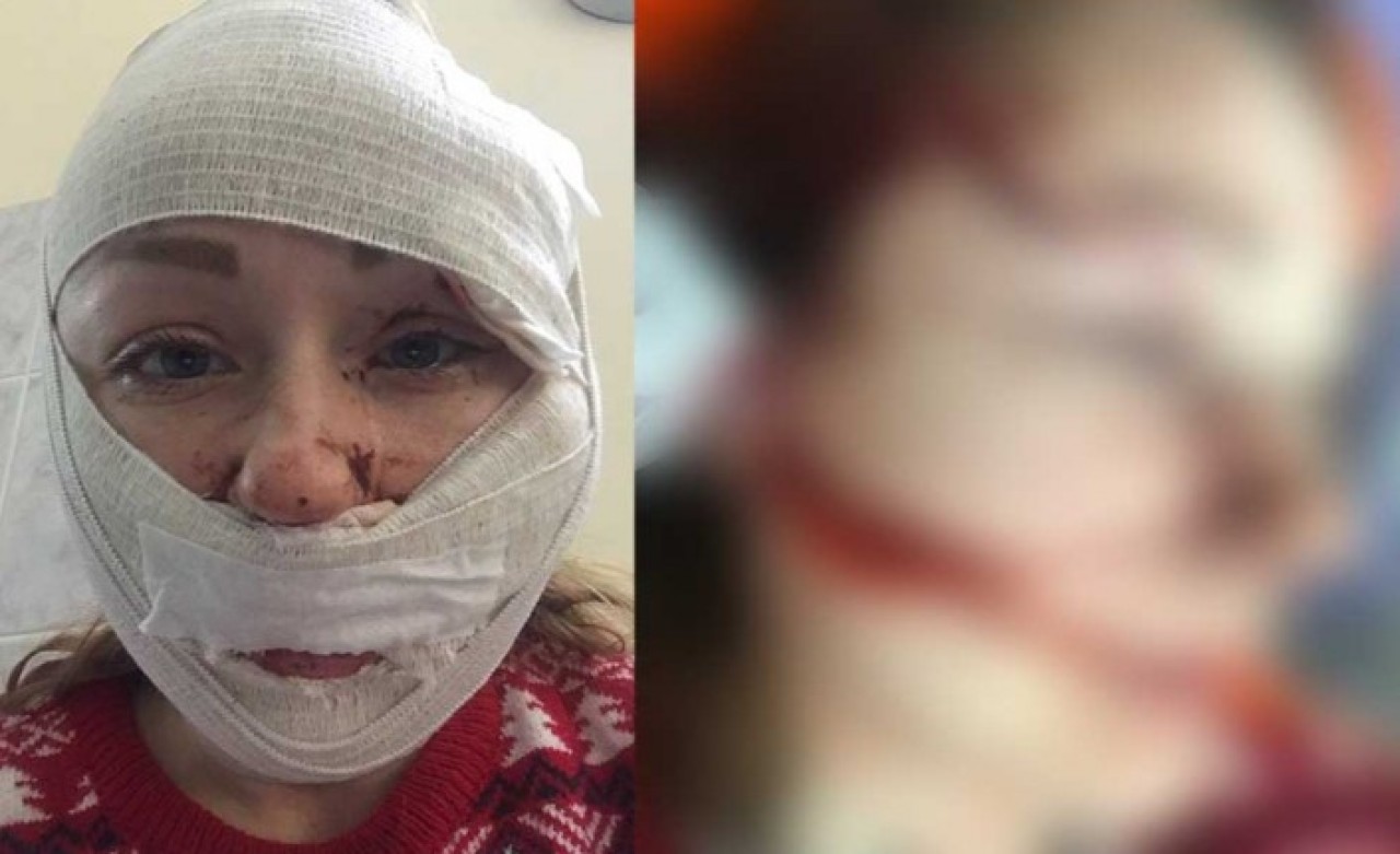 Kocaeli'de dehşet: Mesut Öztürkmen,  eşi Anna Butim'e falçata ile saldırdı: Görüntüler görenlerin içini sızlattı