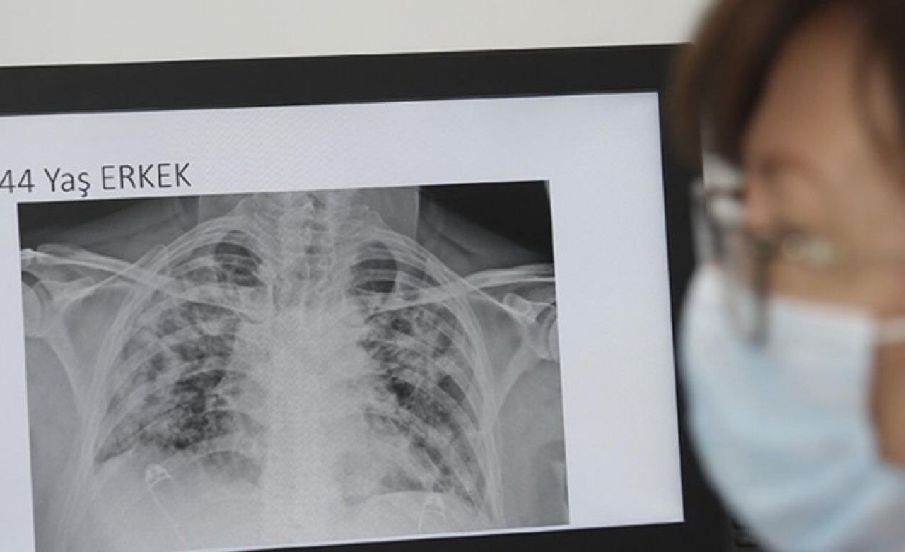 Koronavirüsün korkunç etkisi ortaya çıktı