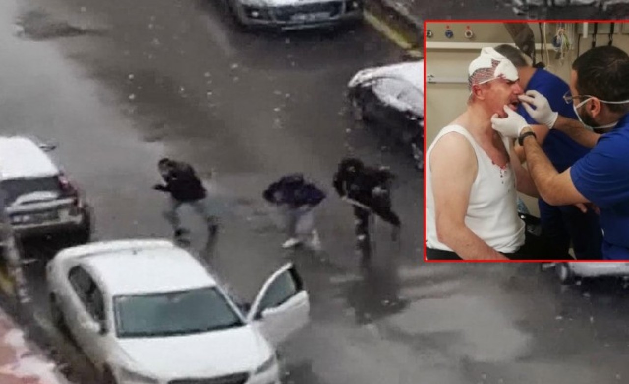 Selçuk Özdağ'a saldıranların ifadeleri ortaya çıktı