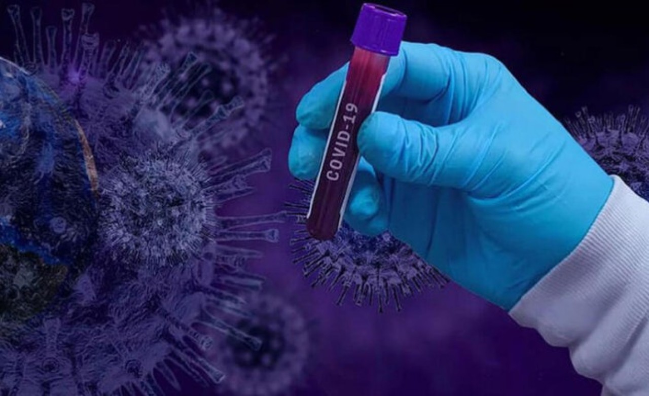 Bilim Kurulu üyesi 'Çok tehlikeli' dedi ve ekledi: 23 ilde mutasyonlu virüs görüldü!