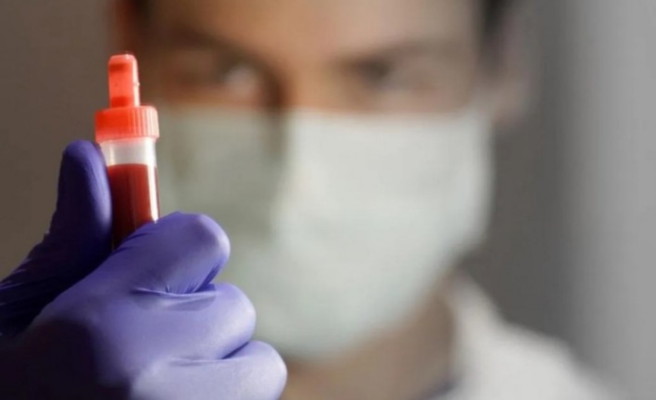 Koronavirüsü atlatanlar dikkat! Antikor kaç ay koruyor?