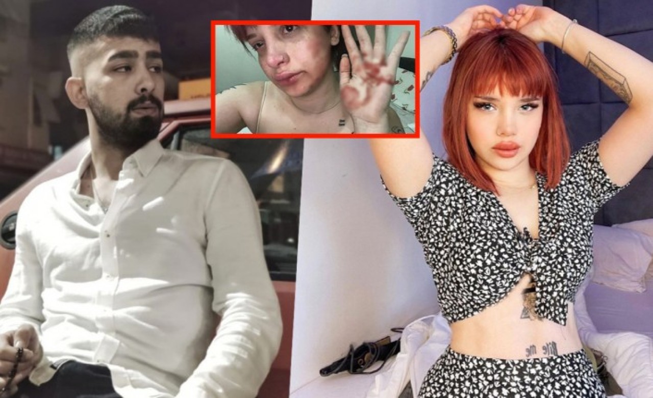 Fenomen Başak Ermiş'e oyuncu Can Topçu'dan tayt dayağı!