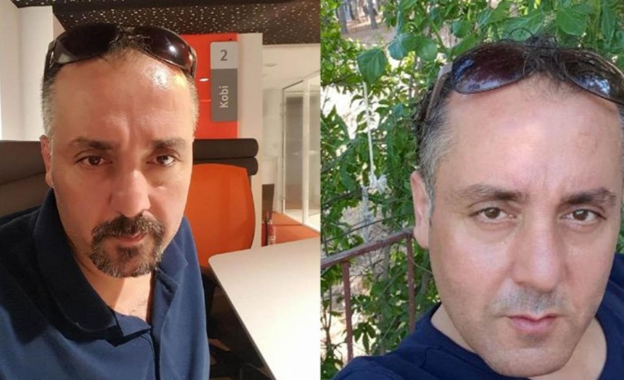 Eski kız arkadaşı yüzüne kezzap atmıştı! Gürkan Karpuzoğlu ölü bulundu