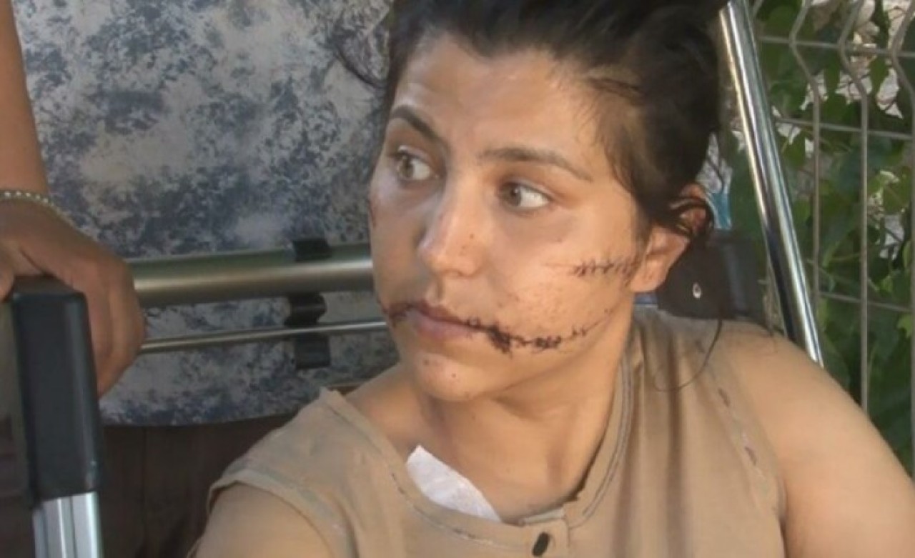 Böyle canilik görülmedi: İzmir'de Aysel Perkgün'ü imam nikahlı eşi 100 yerinden bıçakladı