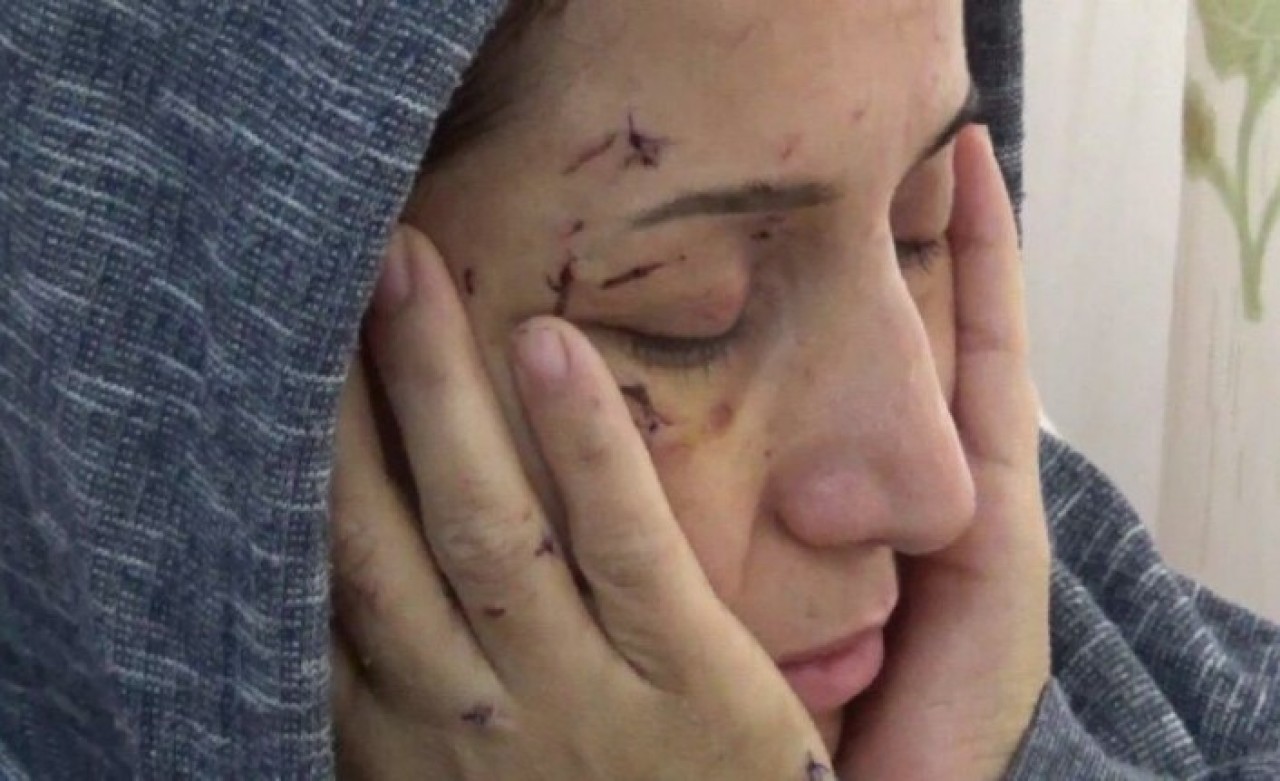 Hatay'da vahşet: Elini öpmeyen yeğenini dövdü,  abi demeyen yengesi Mehtap İlgar'ı 50 kez bıçakladı