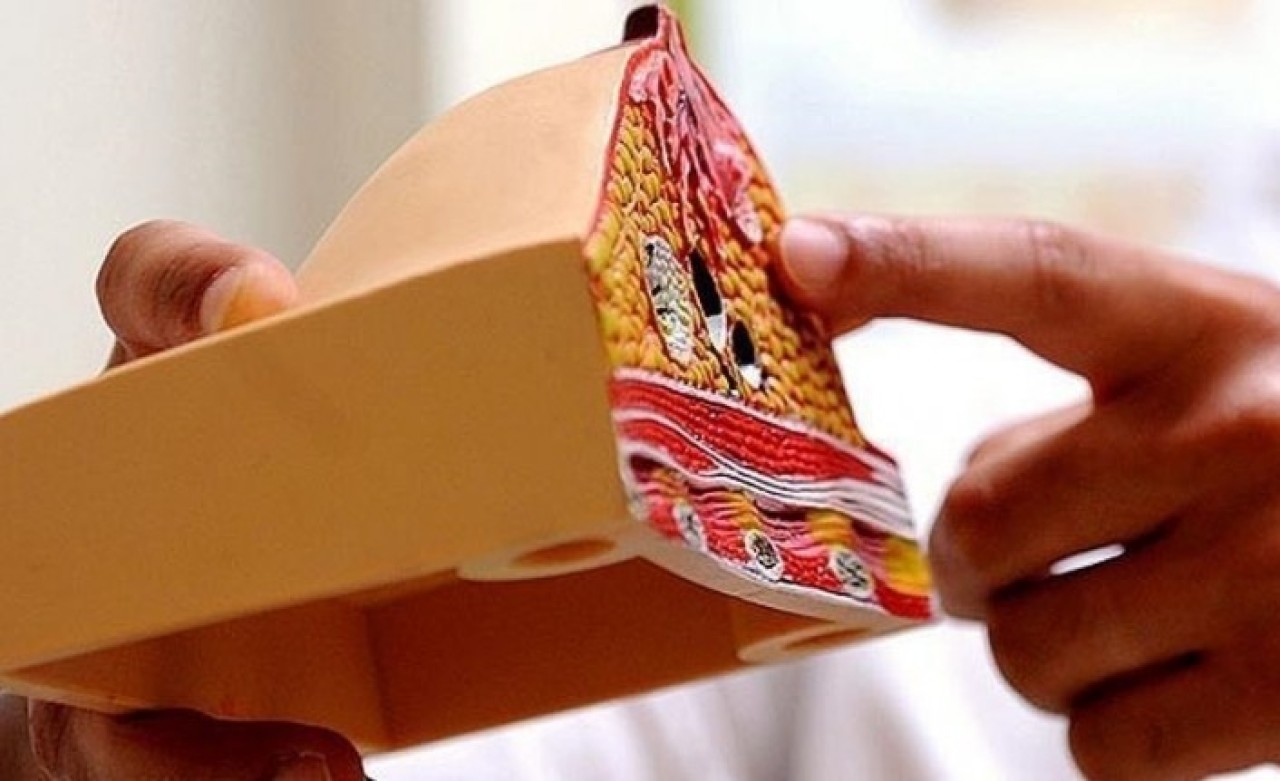 Meme kanserinde erken tanı ve tedavi yaşam kalitesini etkilemeden şifa veriyor