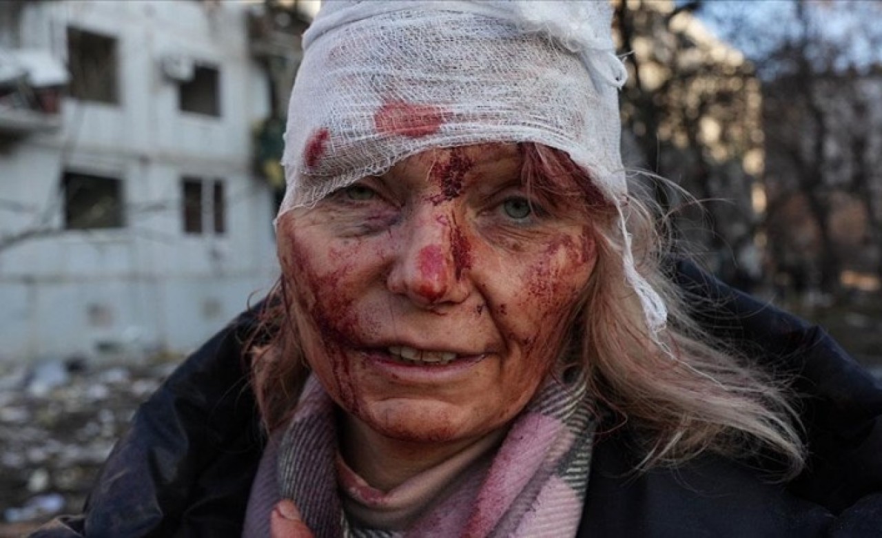 Rusya kentleri vuruyor! Ukrayna'da son durum: Kan,  vahşet,  gözyaşı
