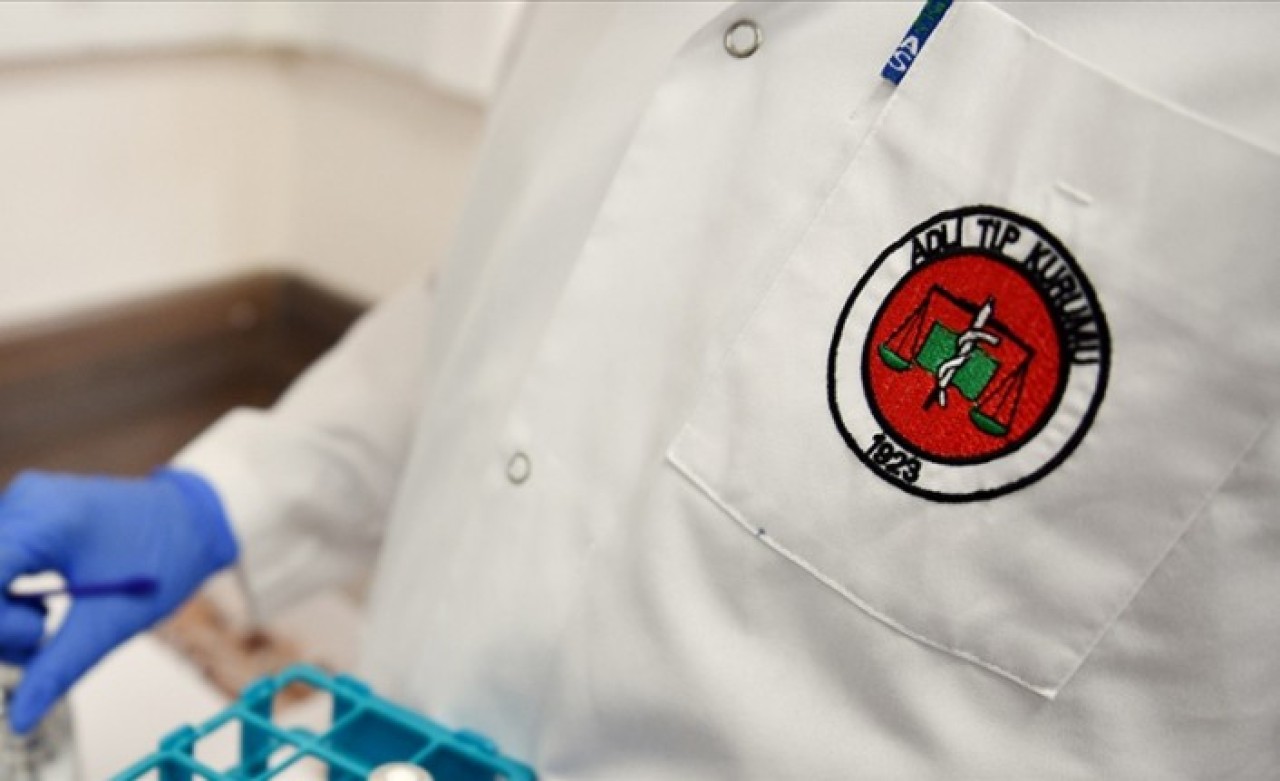 Adli Tıp Kurumu Başkanlığına 124 sözleşmeli personel alınacak