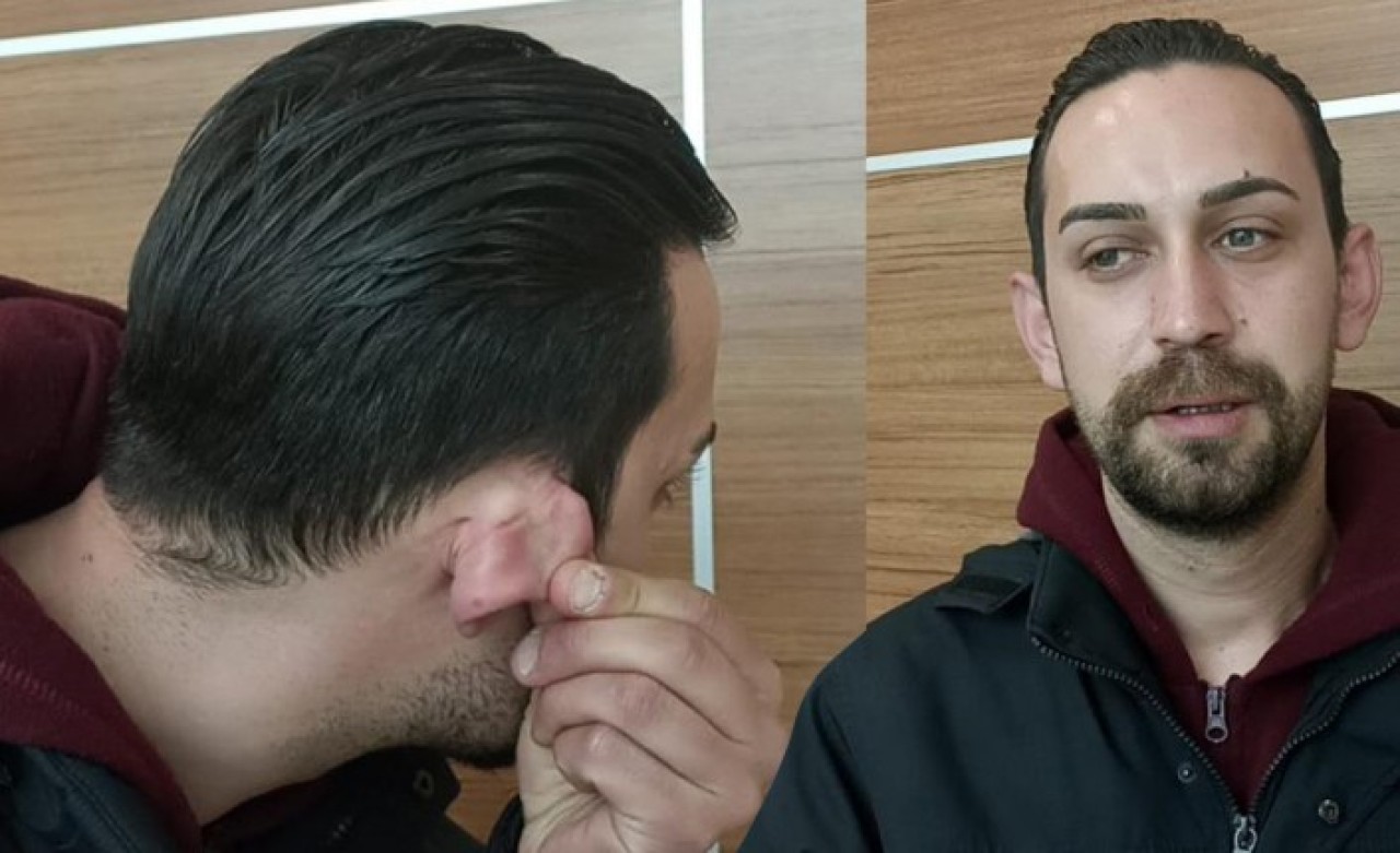 Pes artık! Bolu'da Iraklı göçmen kendisine sigara vermeyen Uğur Akayoğlu'na bakın ne yaptı?