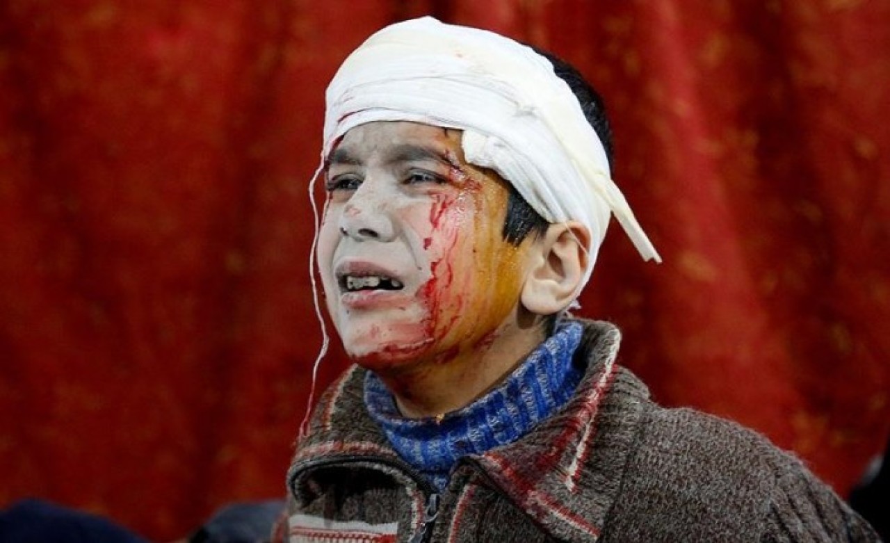 Bomba içinde bomba!Misket bombalarından zarar görenlerin yarıya yakını çocuk