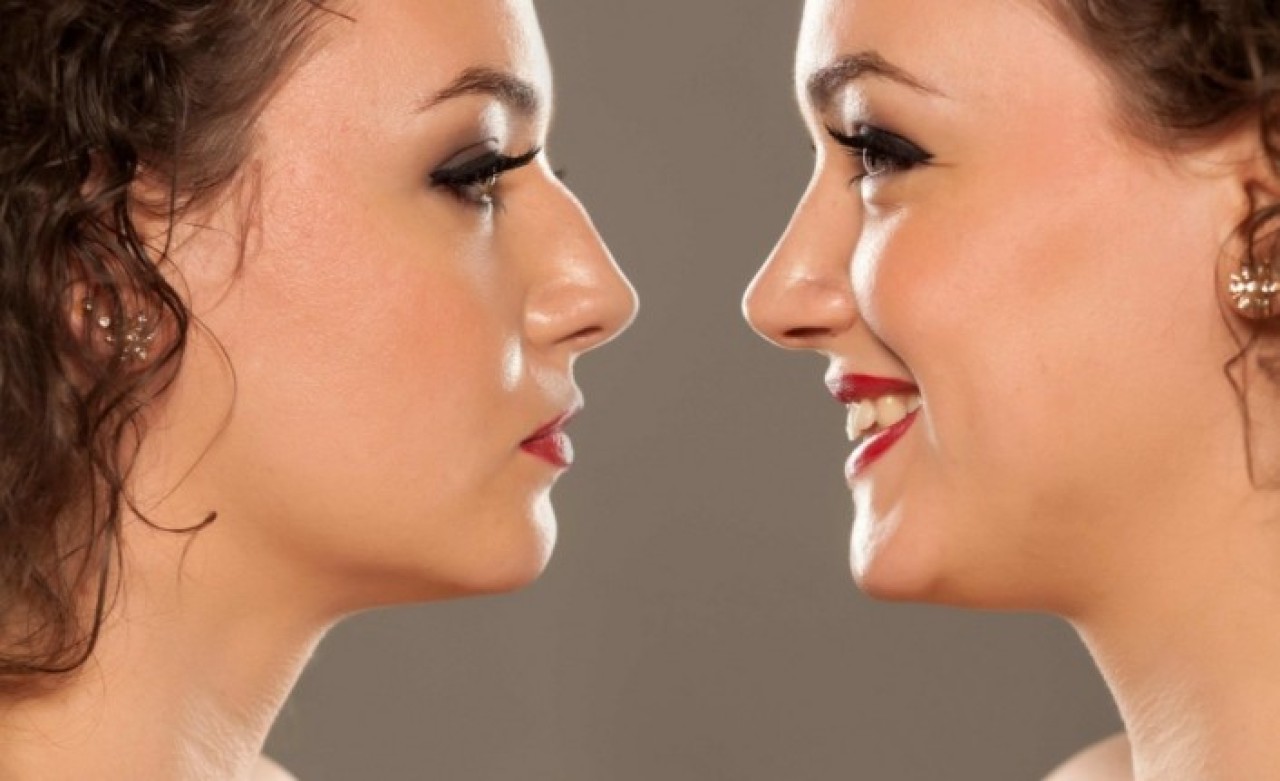 BURUN ESTETİĞİ İLE YÜZDE ALTIN ORAN ETKİSİ