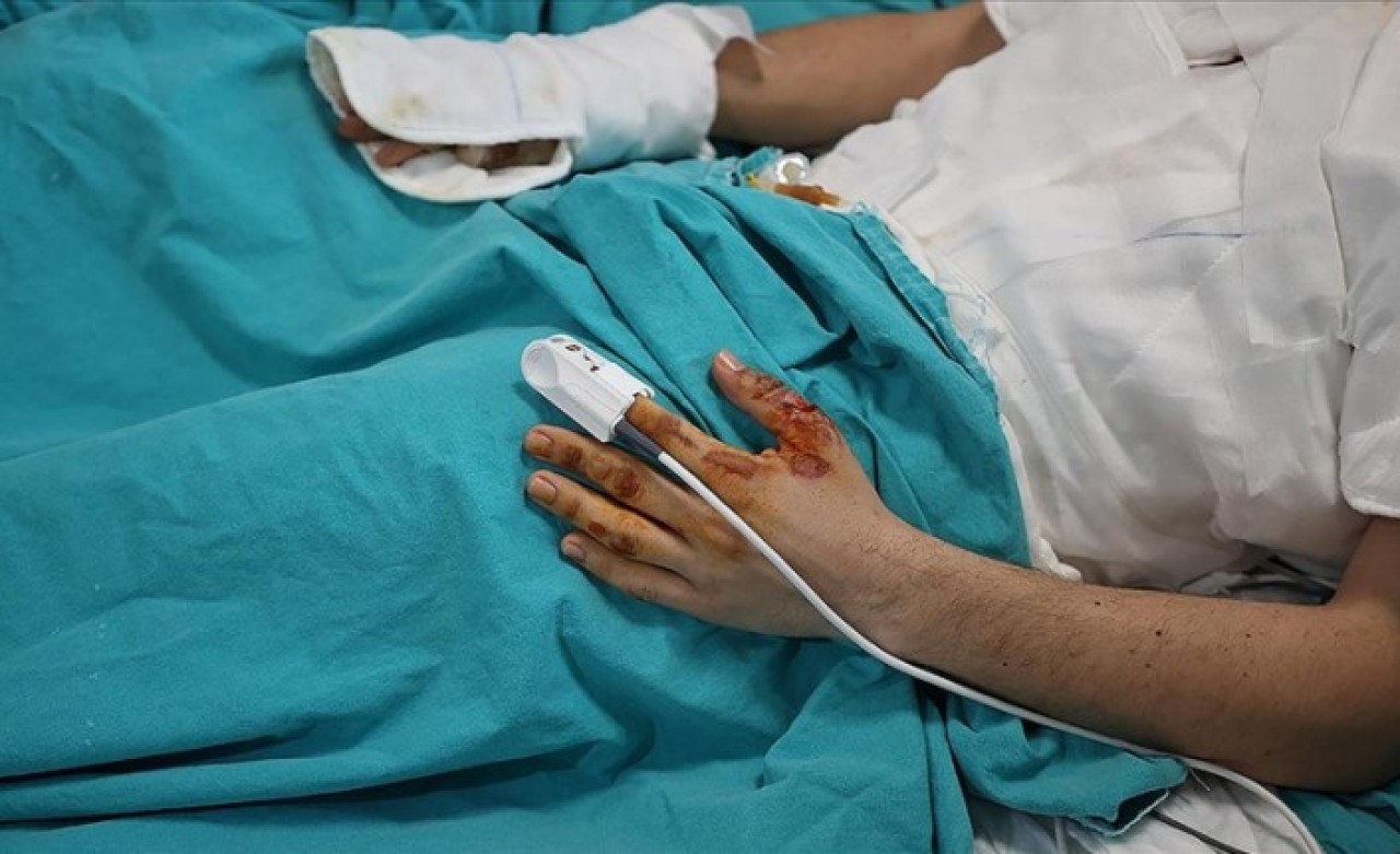 Evdeki anlık dikkatsizlik hasarı ömür boyu taşınabilecek ağır yanıklara yol açabiliyor