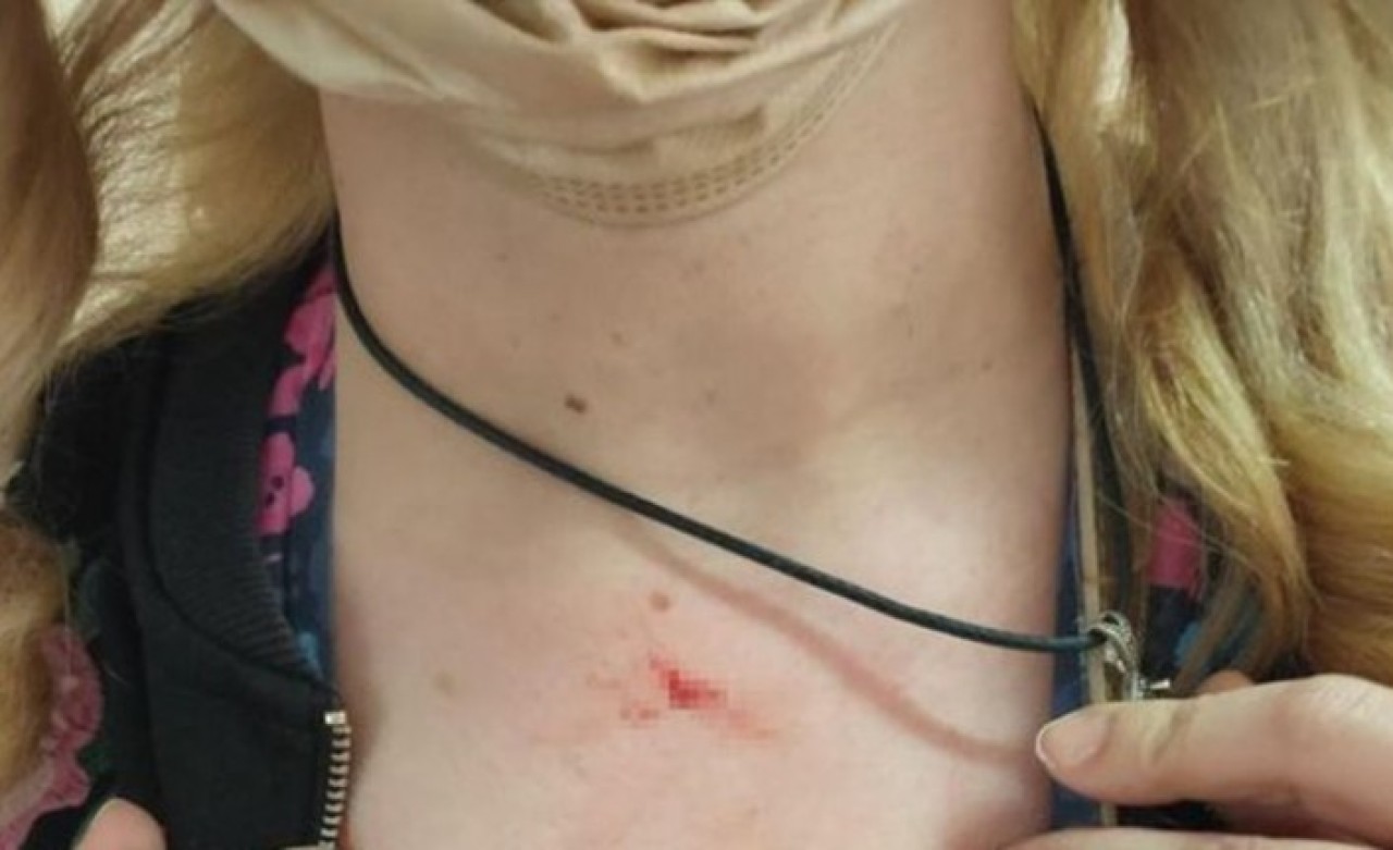 Yuh artık! Kayseri'de 65 yaşındaki kadın doktor Tuba Karauz ile ebe Fatma Bozbıyık'a saldırdı