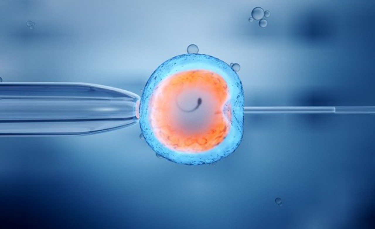 Tüp Bebek Tedavisi Nasıl Yapılır?