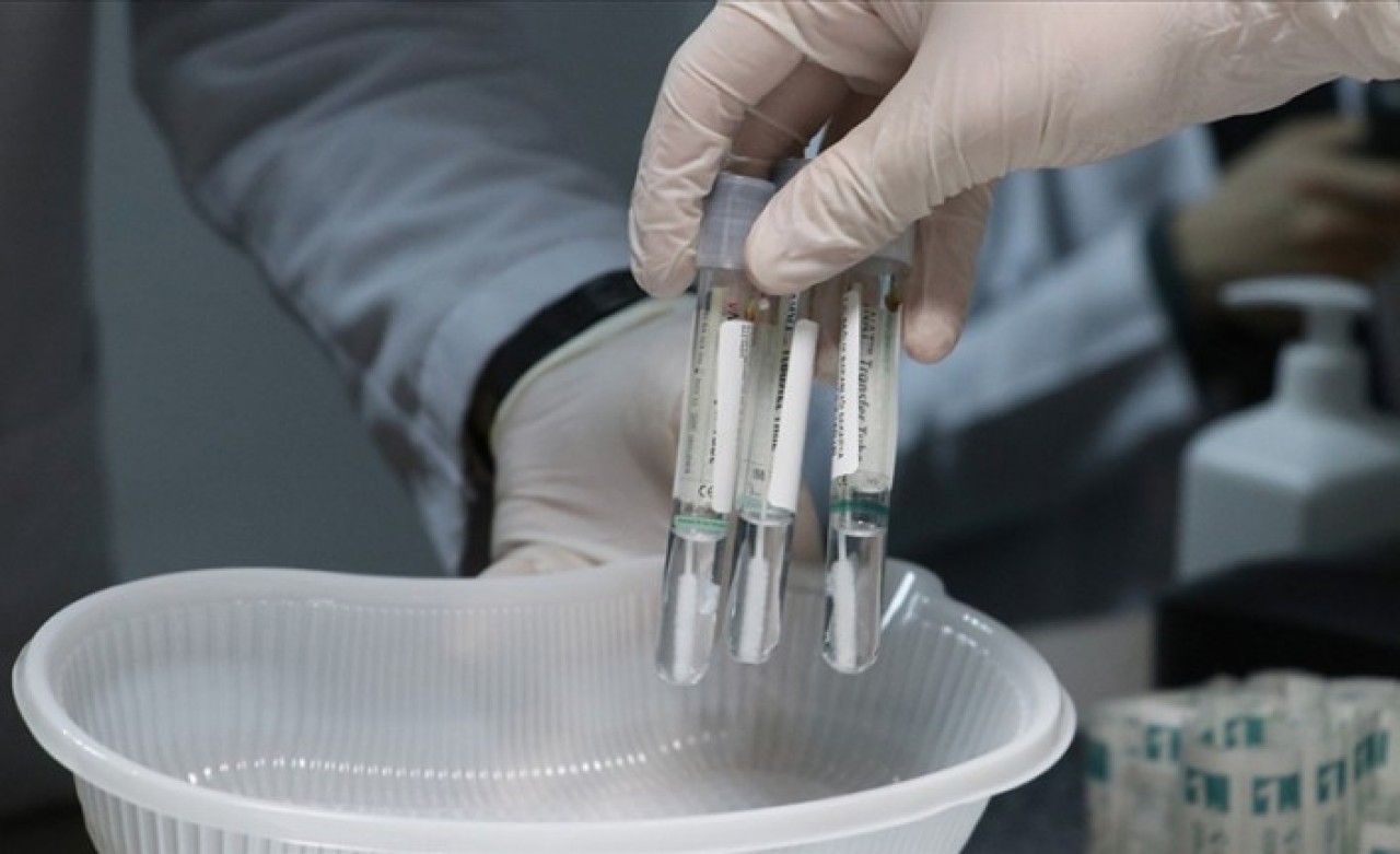 Sağlık Bakanlığı haftalık Kovid-19 verilerini açıkladı