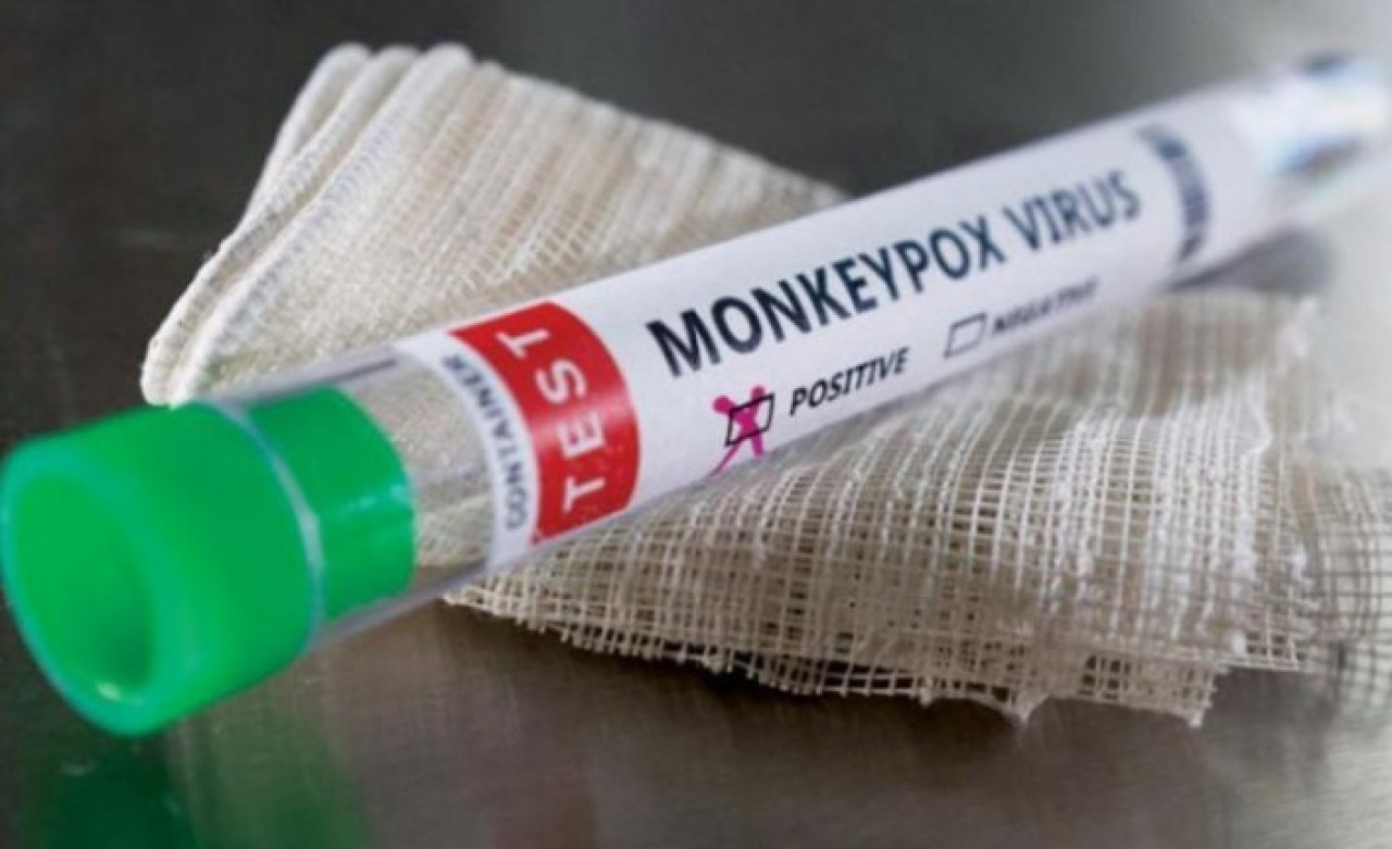 Uzmanlar belirtilerle ilgili konuştu: Maymun çiçeği ile ilgili korkutan uyarı