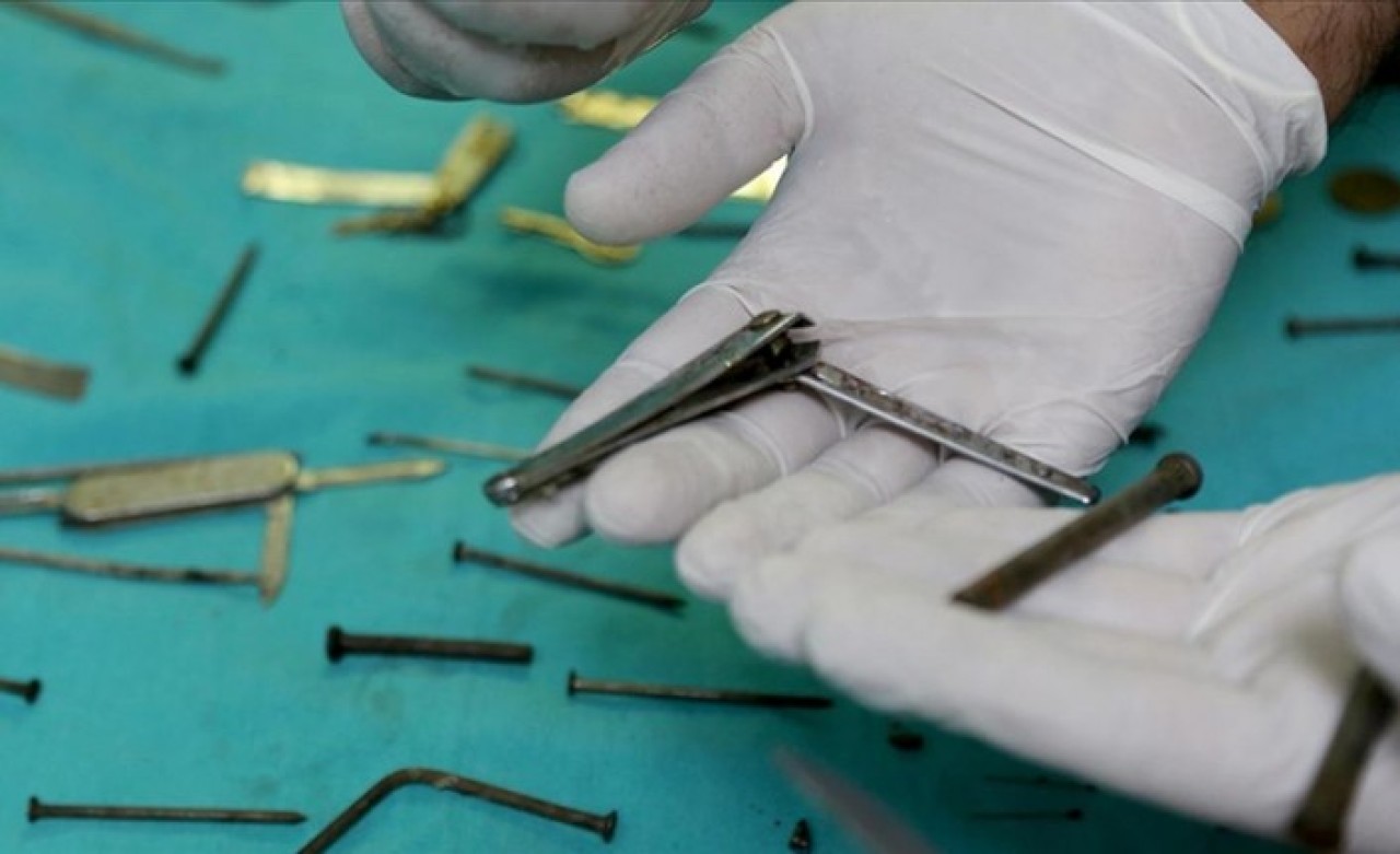 Van'da kadın hastanın midesinden 158 yabancı cisim çıkarıldı