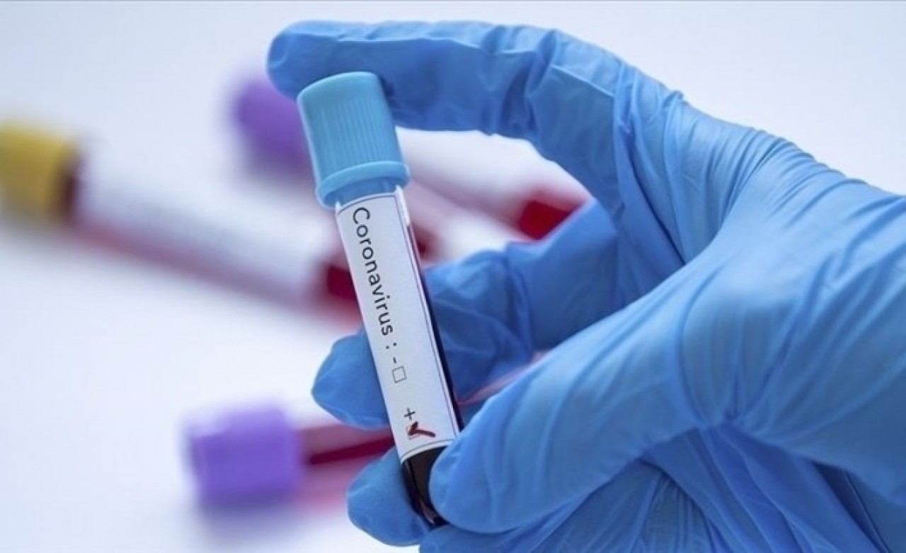 'Yaşadığınız grip değil Kovid-19 olabilir' uyarısı: Belirtileri nedir?