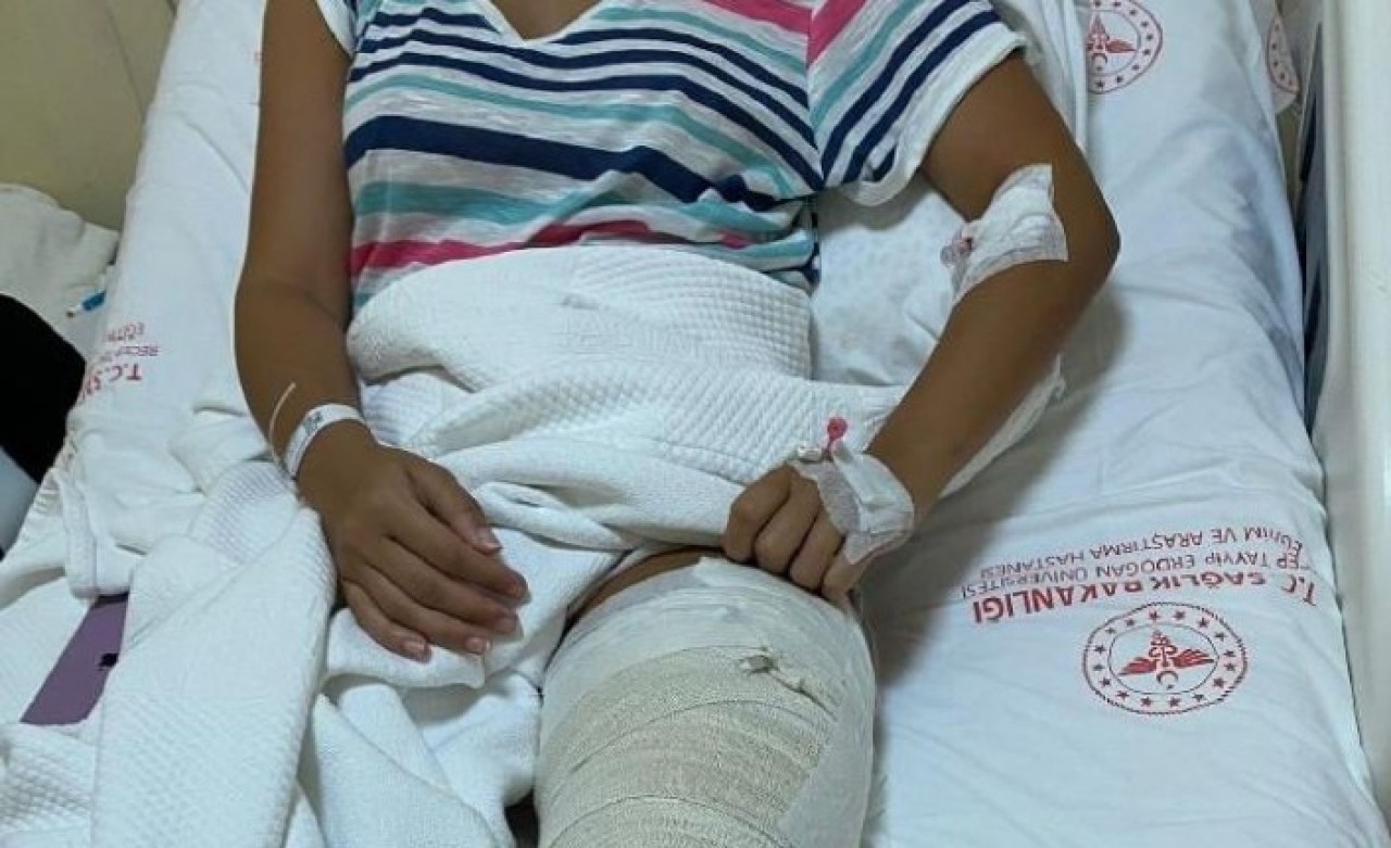 Bu kadarına da pes: Rize'de denize giren Ece İslamoğlu bacağından vuruldu