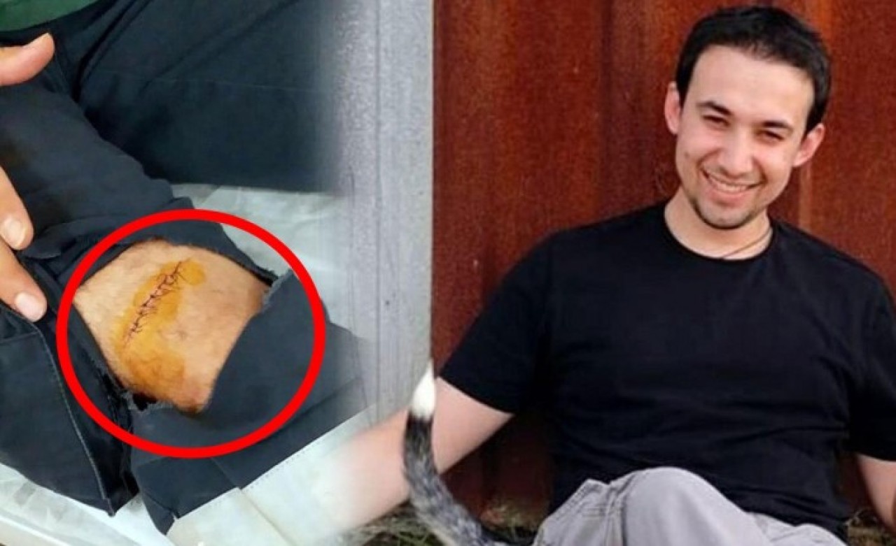 Sağlık çalışanı Kaan Kanat'ın dizine makas saplayan saldırgan serbest bırakıldı